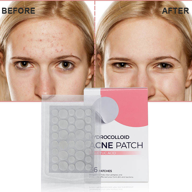 Hydrocolloid Salicylic Acid Acne Pimple Patch